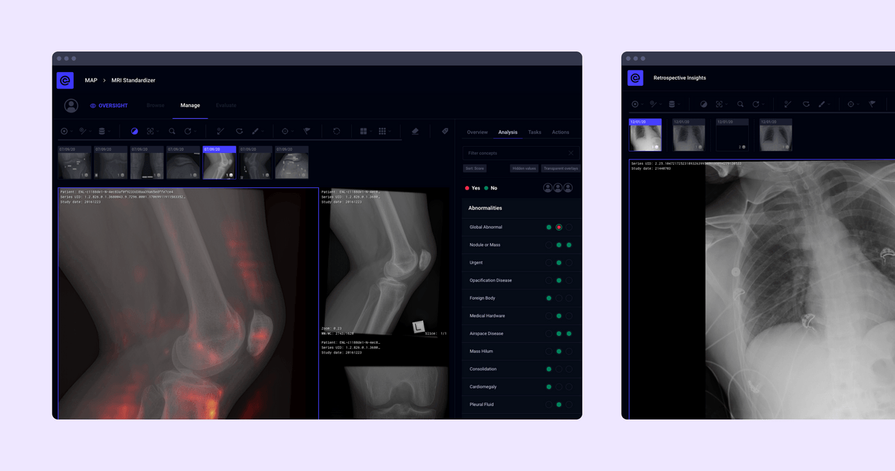 2 screenshots of the Enlitic MRI standardiser and Retrospective insights juxtaposed side by side